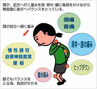 日記 伊丹の整体とは違う 治療系カイロプラクティック